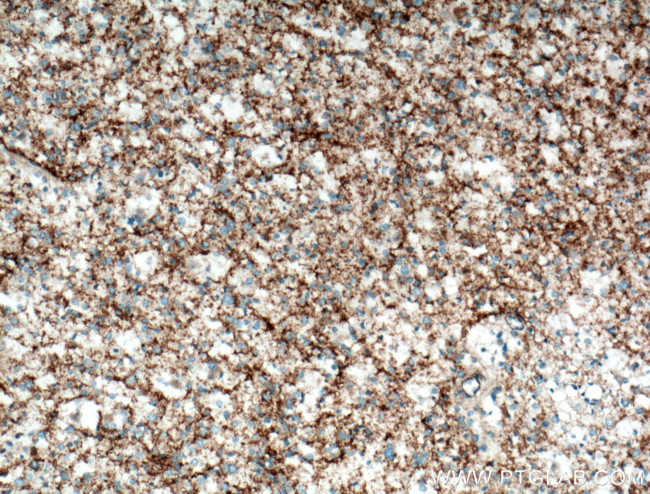 SEPT5 Antibody in Immunohistochemistry (Paraffin) (IHC (P))