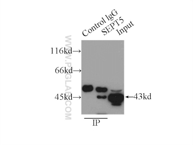 SEPT5 Antibody in Immunoprecipitation (IP)