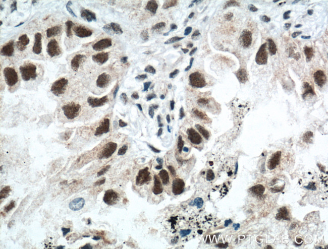 ZMYND8 Antibody in Immunohistochemistry (Paraffin) (IHC (P))