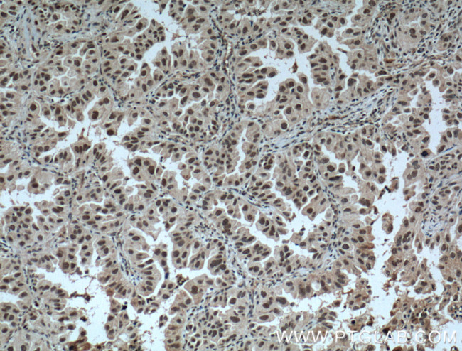 ZMYND8 Antibody in Immunohistochemistry (Paraffin) (IHC (P))