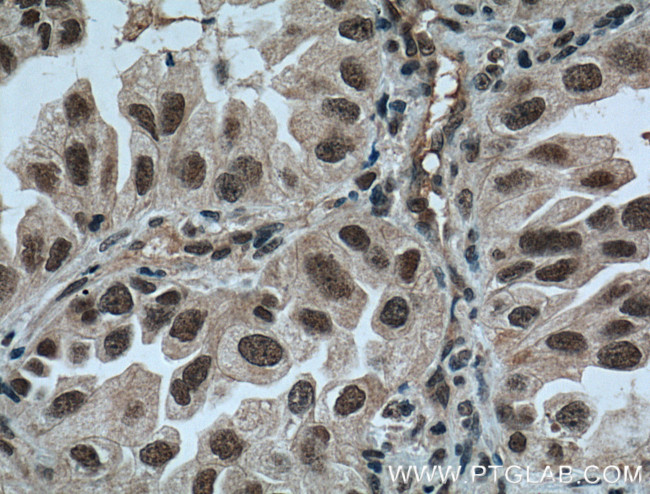 ZMYND8 Antibody in Immunohistochemistry (Paraffin) (IHC (P))