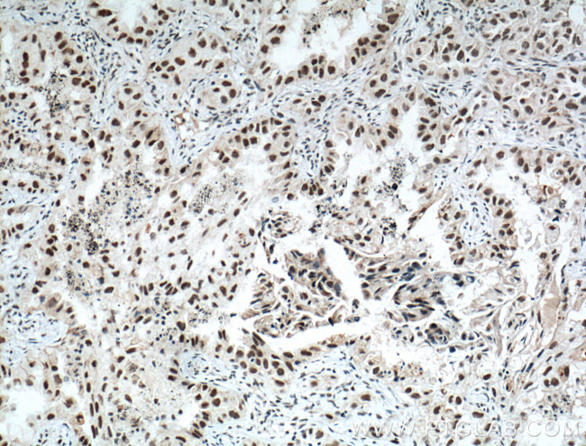 ZMYND8 Antibody in Immunohistochemistry (Paraffin) (IHC (P))