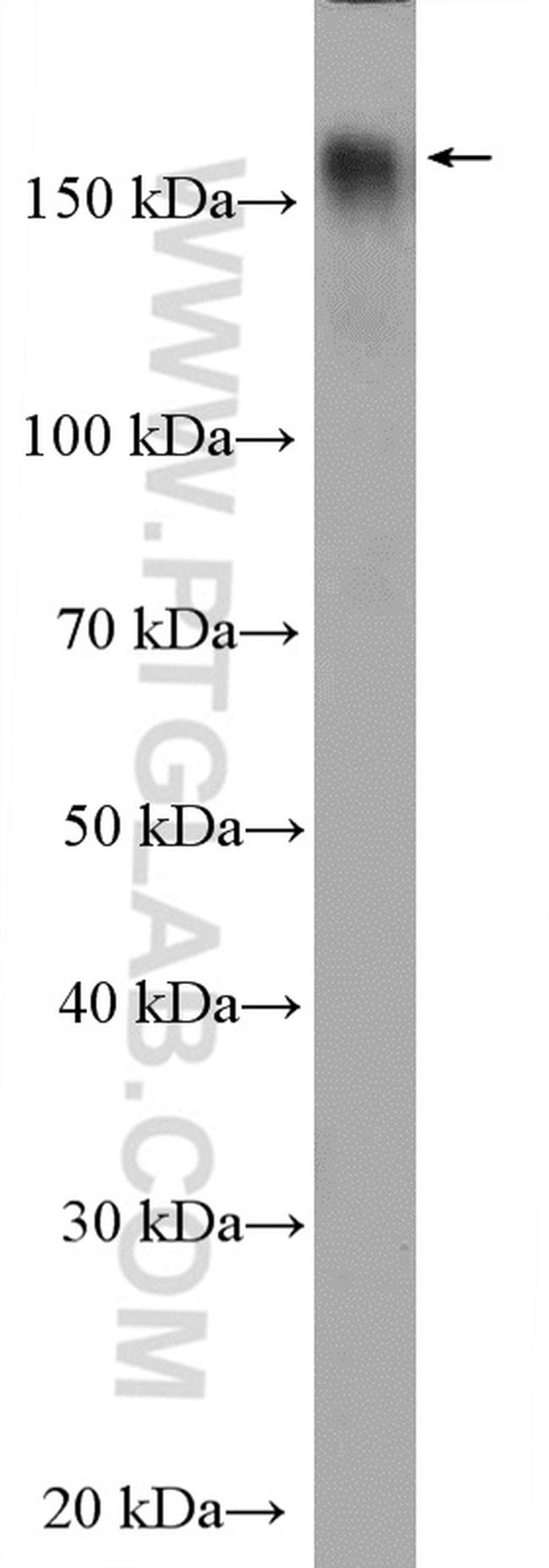 ZMYND8 Antibody in Western Blot (WB)