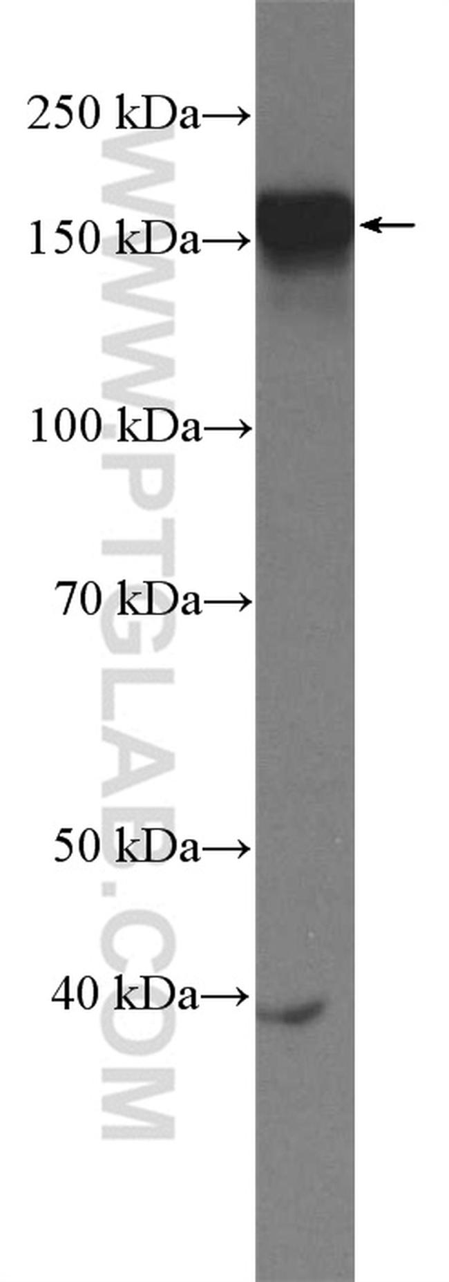 ZMYND8 Antibody in Western Blot (WB)