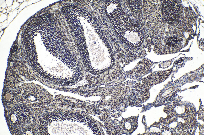 SF1 Antibody in Immunohistochemistry (Paraffin) (IHC (P))