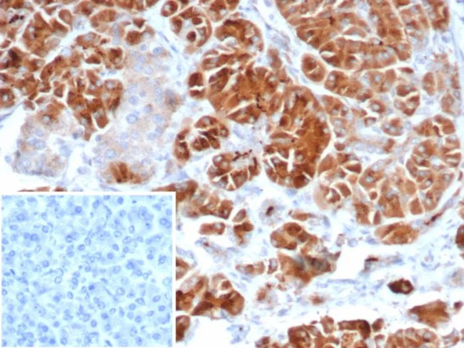 IL22RA2 Antibody in Immunohistochemistry (Paraffin) (IHC (P))