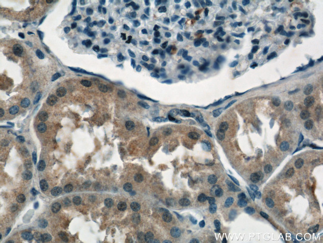 NPLOC4 Antibody in Immunohistochemistry (Paraffin) (IHC (P))