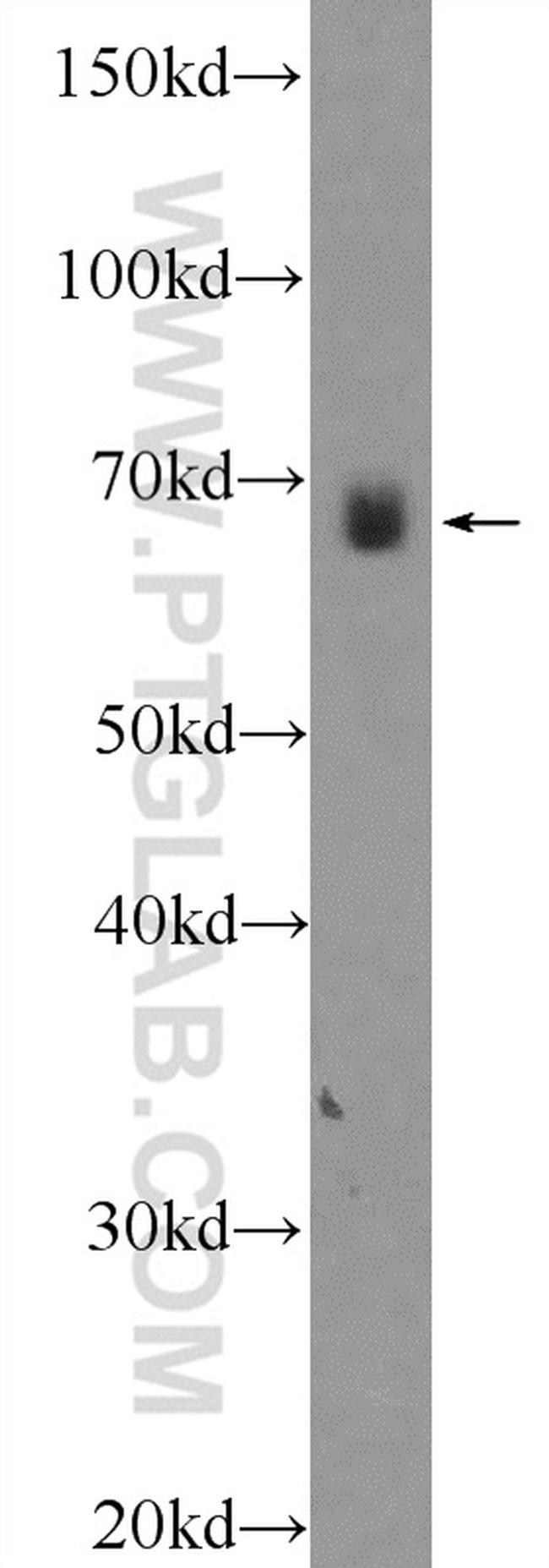 NPLOC4 Antibody in Western Blot (WB)