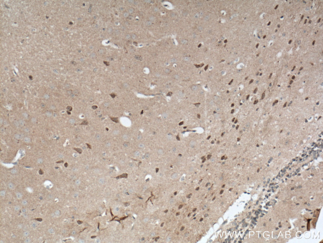 CDC6 Antibody in Immunohistochemistry (Paraffin) (IHC (P))