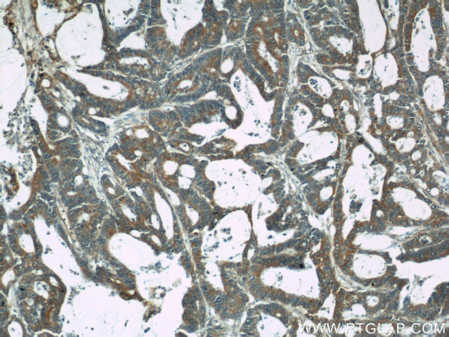 CDC6 Antibody in Immunohistochemistry (Paraffin) (IHC (P))