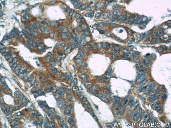 CDC6 Antibody in Immunohistochemistry (Paraffin) (IHC (P))