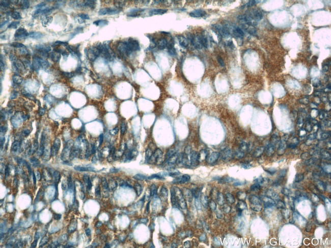 CDC6 Antibody in Immunohistochemistry (Paraffin) (IHC (P))