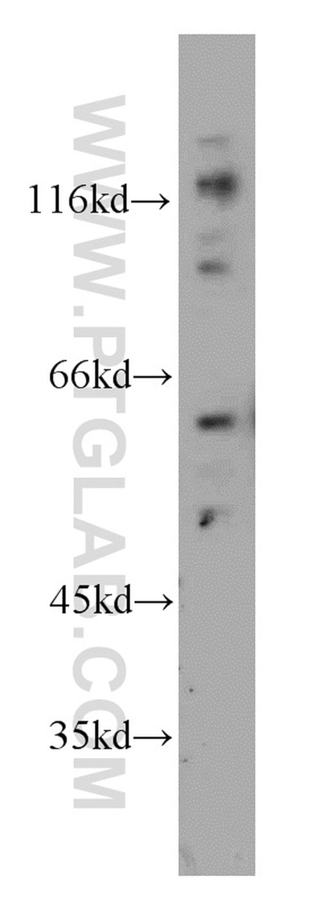 CDC6 Antibody in Western Blot (WB)