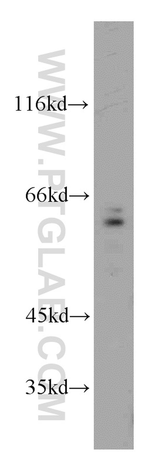 CDC6 Antibody in Western Blot (WB)