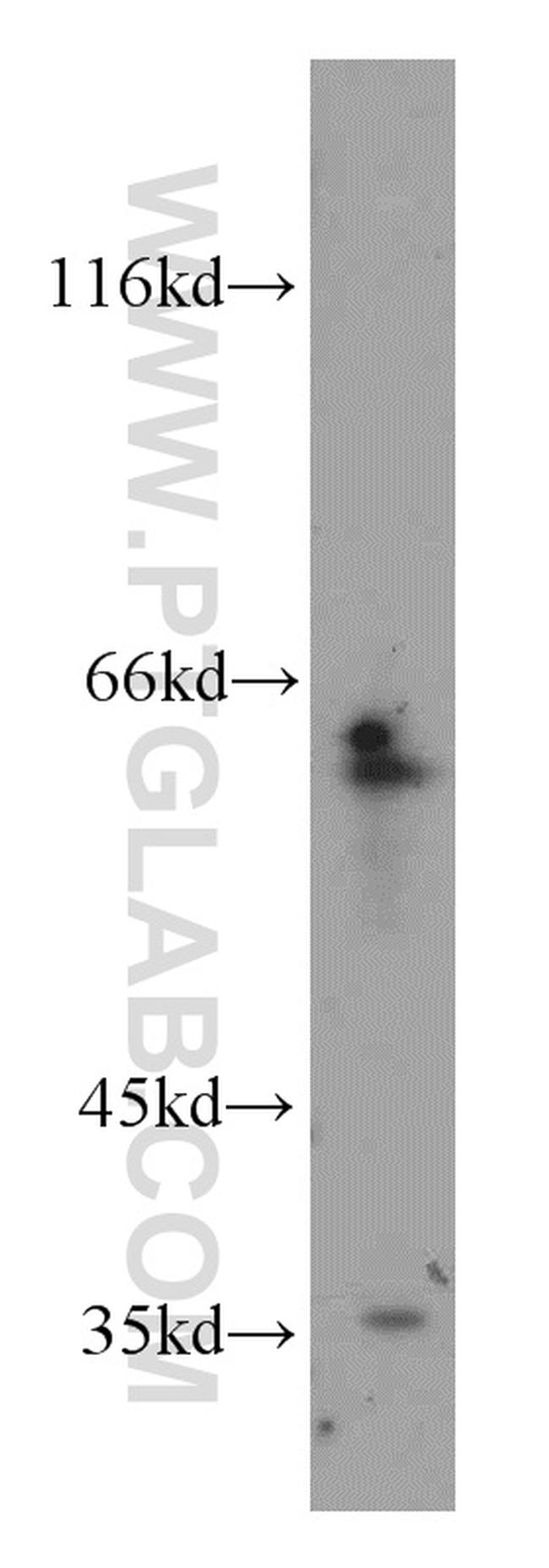 CDC6 Antibody in Western Blot (WB)