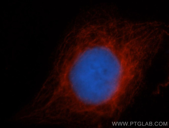 CDC6 Antibody in Immunocytochemistry (ICC/IF)