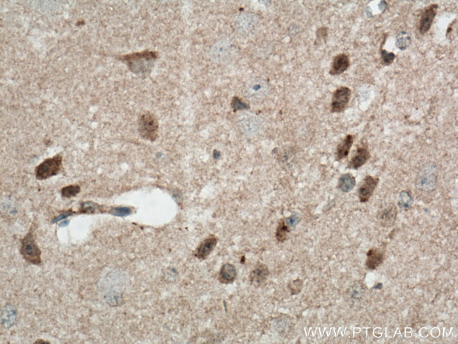 CDC6 Antibody in Immunohistochemistry (Paraffin) (IHC (P))