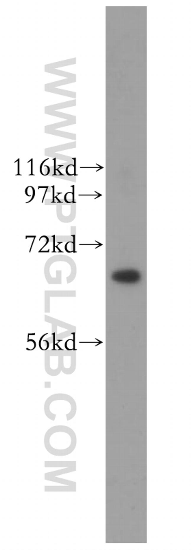 CDC6 Antibody in Western Blot (WB)