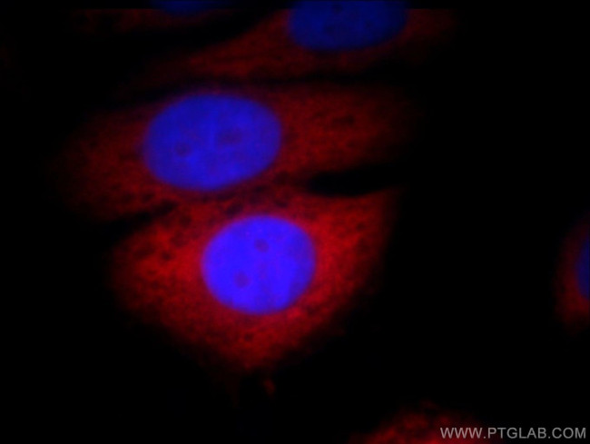 GNAI3 Antibody in Immunocytochemistry (ICC/IF)