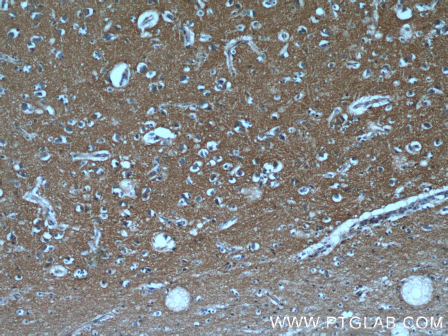 GNAI3 Antibody in Immunohistochemistry (Paraffin) (IHC (P))