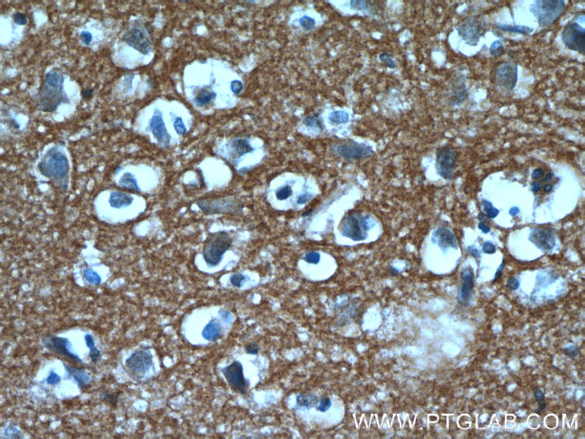 GNAI3 Antibody in Immunohistochemistry (Paraffin) (IHC (P))