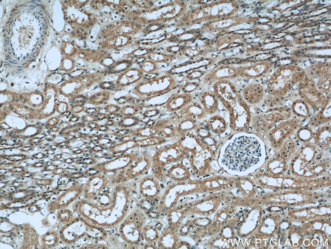 GNAI3 Antibody in Immunohistochemistry (Paraffin) (IHC (P))