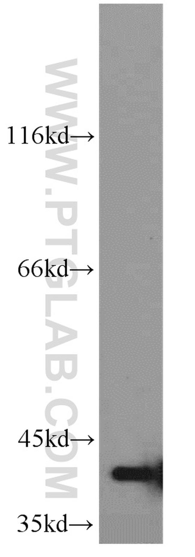 GNAI3 Antibody in Western Blot (WB)