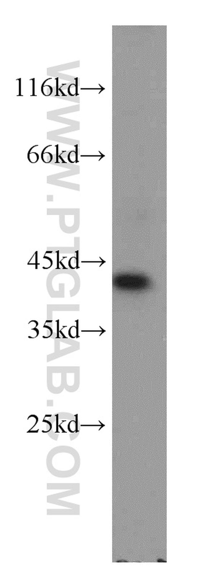 GNAI3 Antibody in Western Blot (WB)