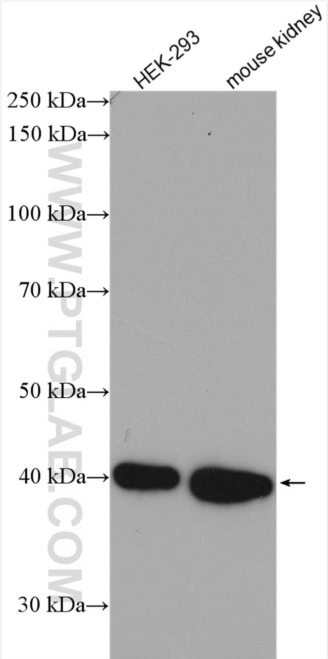 GNAI3 Antibody in Western Blot (WB)