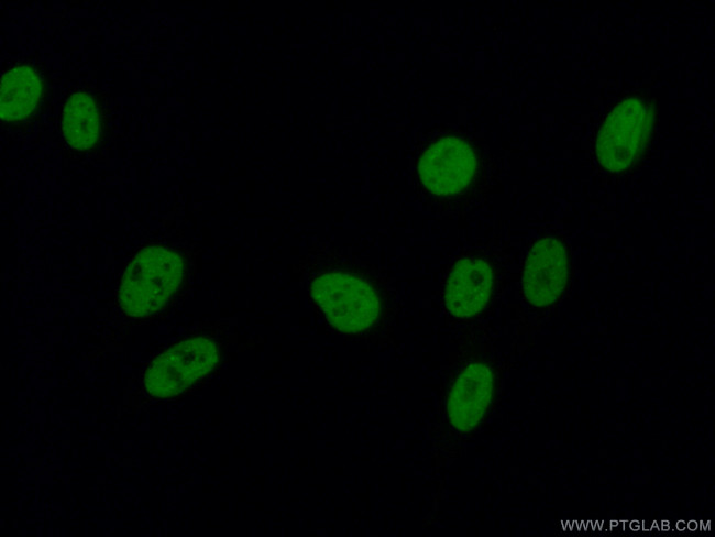 SAFB2 Antibody in Immunocytochemistry (ICC/IF)