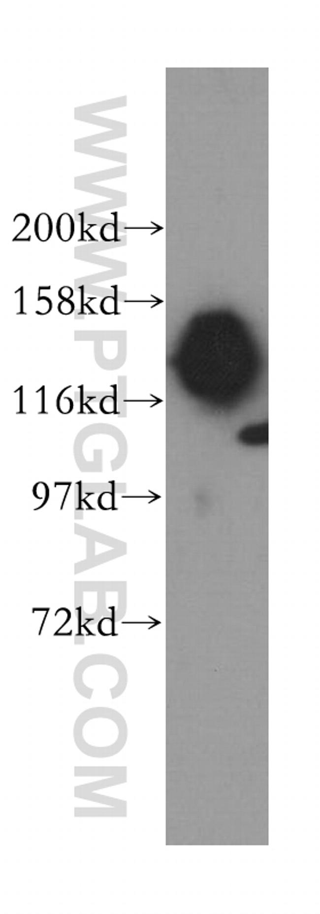 SAFB2 Antibody in Western Blot (WB)