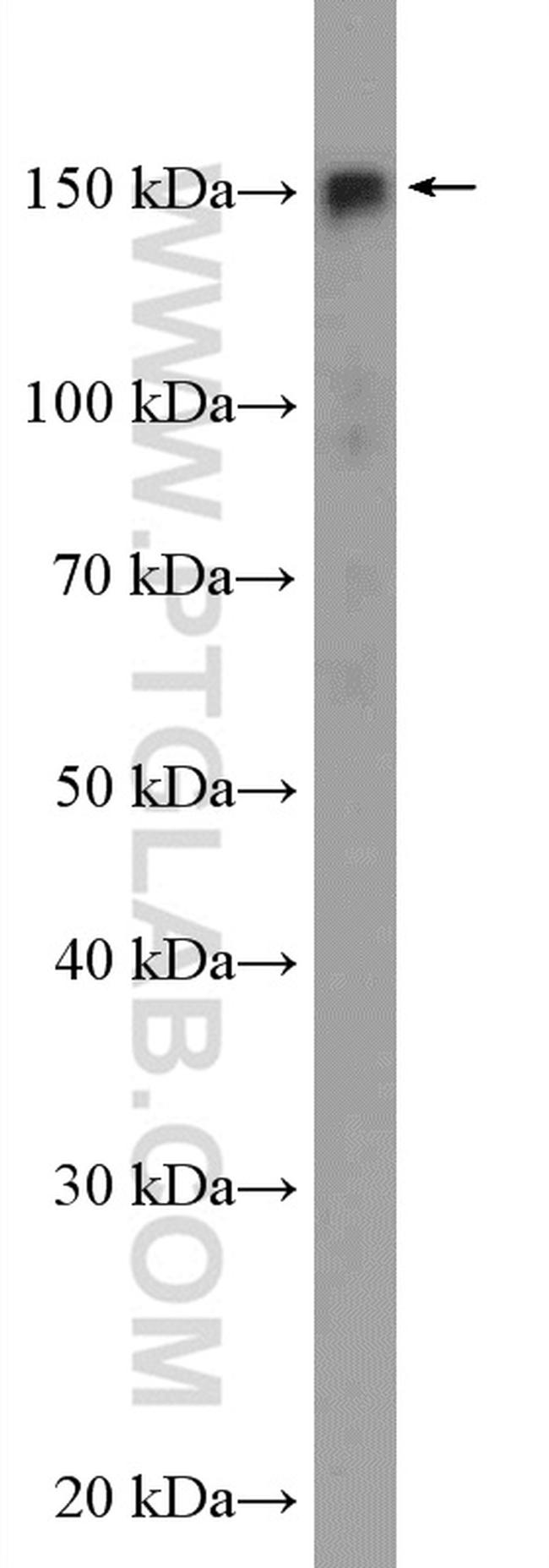 SAFB2 Antibody in Western Blot (WB)