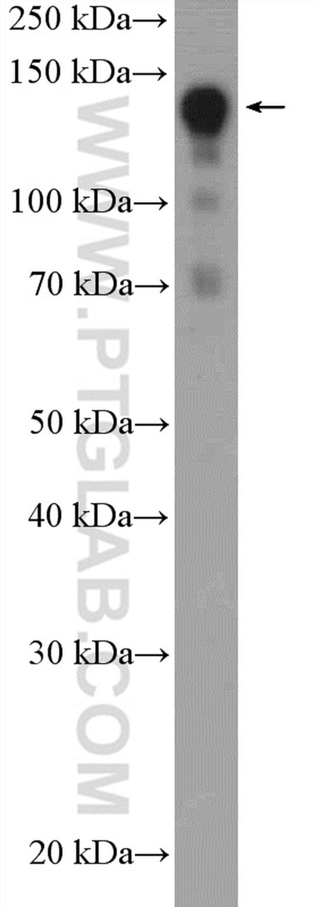 SAFB2 Antibody in Western Blot (WB)