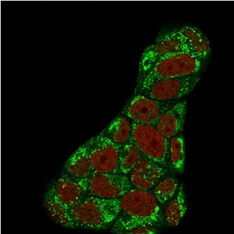 Topoisomerase I, Mitochondrial (TOP1MT) Antibody in Immunocytochemistry (ICC/IF)