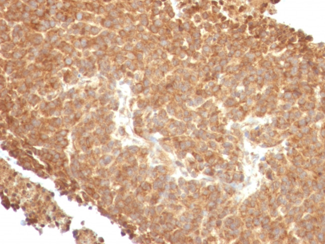 Topoisomerase I, Mitochondrial (TOP1MT) Antibody in Immunohistochemistry (Paraffin) (IHC (P))