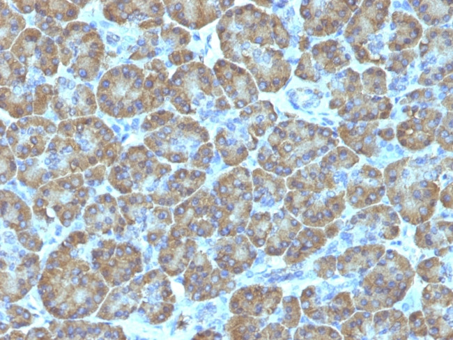 Topoisomerase I, Mitochondrial (TOP1MT) Antibody in Immunohistochemistry (Paraffin) (IHC (P))