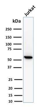 Topoisomerase I, Mitochondrial (TOP1MT) Antibody in Western Blot (WB)