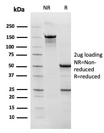 Topoisomerase (DNA) I, Mitochondrial (TOP1MT) Antibody in SDS-PAGE (SDS-PAGE)