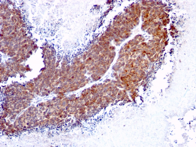 Topoisomerase (DNA) I, Mitochondrial (TOP1MT) Antibody in Immunohistochemistry (Paraffin) (IHC (P))