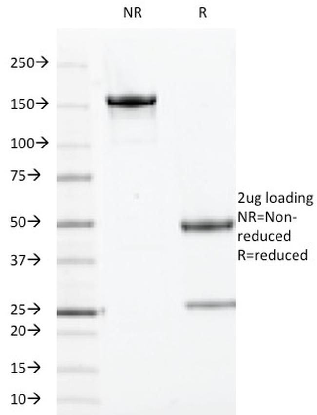 Topoisomerase (DNA) I, Mitochondrial (TOP1MT) Antibody in SDS-PAGE (SDS-PAGE)