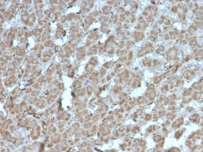 Topoisomerase I, Mitochondrial (TOP1MT) Antibody in Immunohistochemistry (Paraffin) (IHC (P))