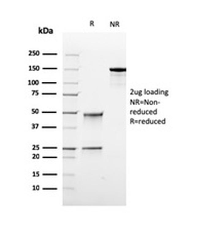 Topoisomerase I Mitochondrial (TOP1MT) Antibody in Immunoelectrophoresis (IE)