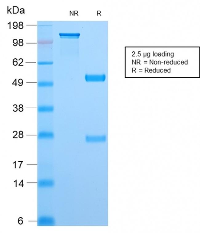 Topoisomerase I, Mitochondrial (TOP1MT) Antibody in SDS-PAGE (SDS-PAGE)