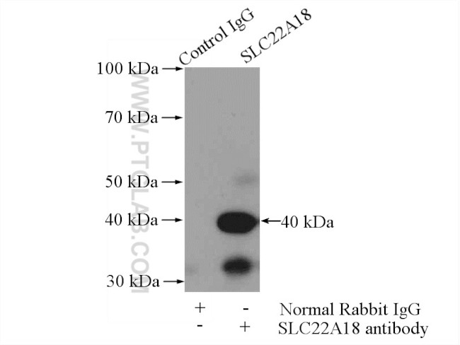 SLC22A18 Antibody in Immunoprecipitation (IP)