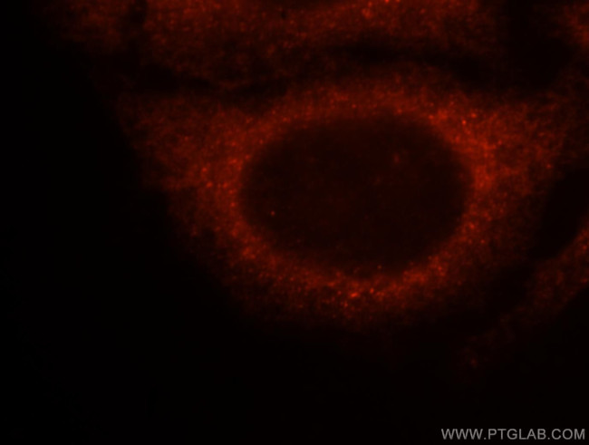 14-3-3 epsilon Antibody in Immunocytochemistry (ICC/IF)