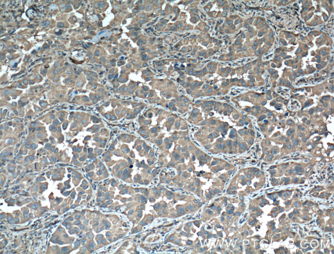 14-3-3 epsilon Antibody in Immunohistochemistry (Paraffin) (IHC (P))