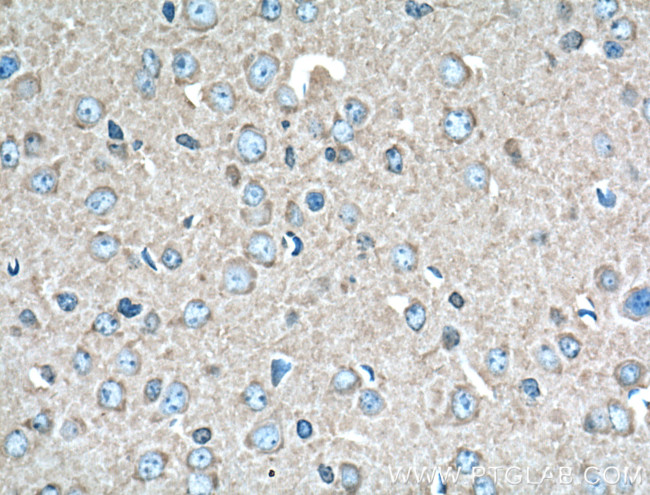 14-3-3 epsilon Antibody in Immunohistochemistry (Paraffin) (IHC (P))