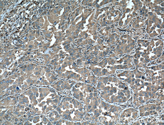 14-3-3 epsilon Antibody in Immunohistochemistry (Paraffin) (IHC (P))