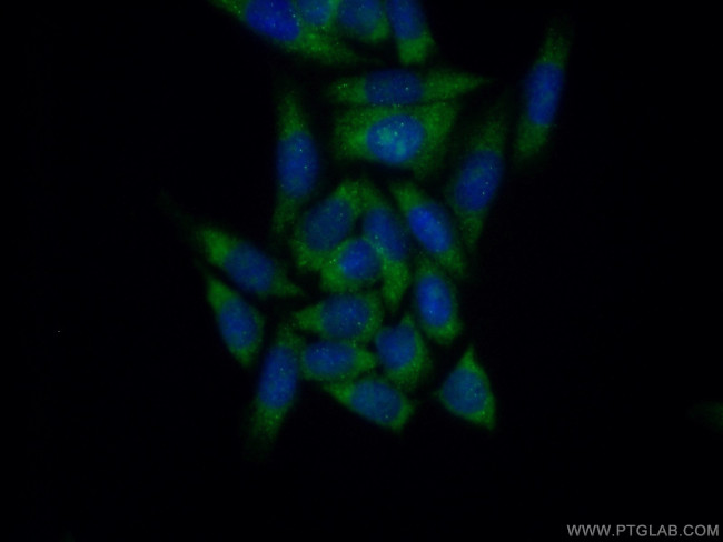 EIF1AX Antibody in Immunocytochemistry (ICC/IF)