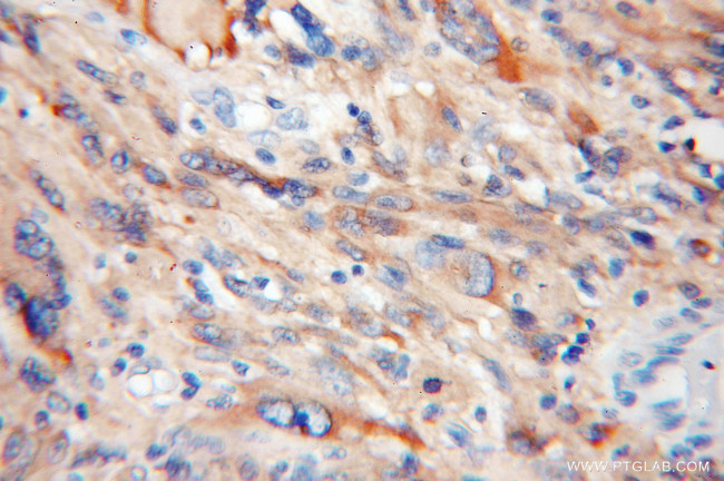 EIF1AX Antibody in Immunohistochemistry (Paraffin) (IHC (P))